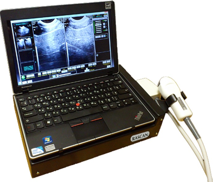 Портативный ультразвуковой сканер РACKAH ЭТС-Д-05ВП ветеринарный