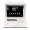 Ультразвуковой сканер SONOSCAPE SSI-1000