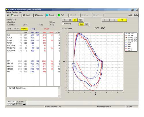 Комплекс компьютерной спирометрии Schiller PC SPIROMETRY