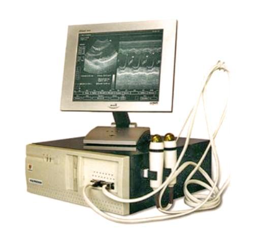 Ультразвуковой сканер- приставка ВЕТЕРИНАР с электронным датчиком
