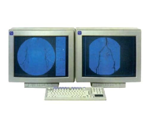 Цифровая радиологическая система FLASH 1200