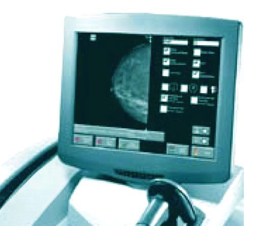 Система компьютерной радиографии KODAK DirectView CR mammography feature