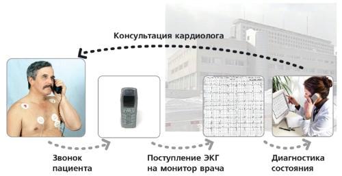 ЭКГ комплекс ТЕЛЕКАРД (Транстелефонный)