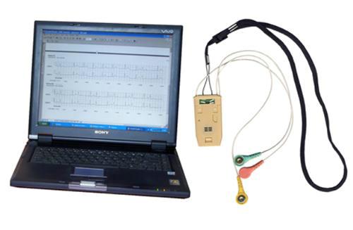 Система амбулаторного мониторирования кардиосигналов ЭЛСКАН