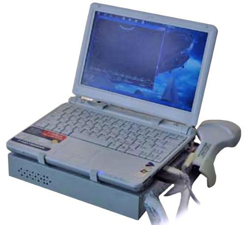 Ультразвуковой сканер УЛЬТРАСКАН с электронным датчиком