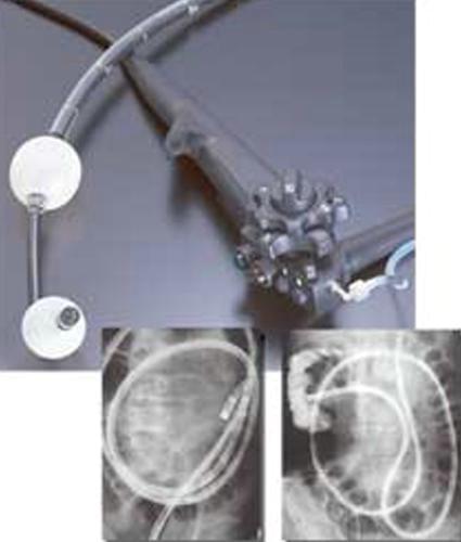Двухбаллонная энтероскопическая система DBE Fujinon