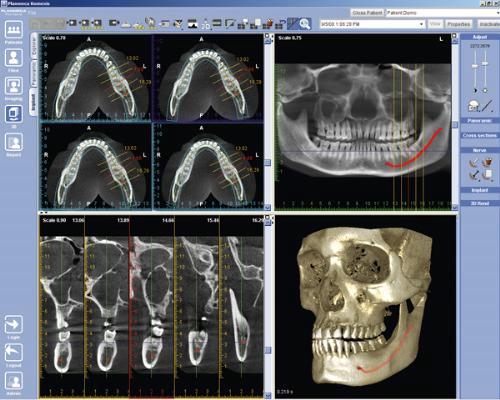 Модуль PLANMECA Romexis 3D Cross Sections