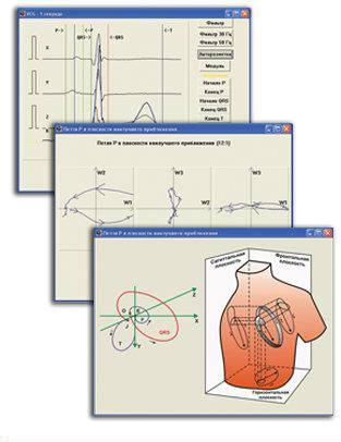 Система для регистрации и анализа ЭКГ ПОКОЯ