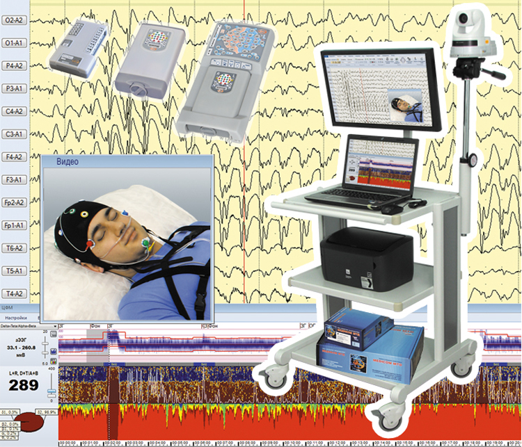 Комплект видеооборудования для ЭЭГ-видеомониторинга и ПМО ЭНЦЕФАЛАН-ВИДЕО