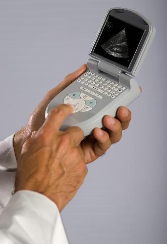Ультразвуковой сканер ACUSON P10
