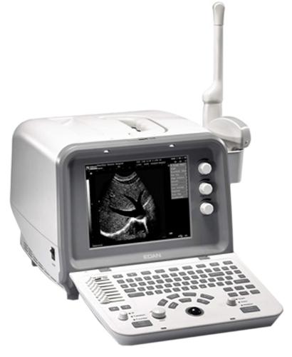 Портативный ультразвуковой сканер SonoFine EUS B (черно-белый)