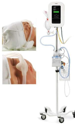 Cистема CPAP для новорожденных NeoPAP