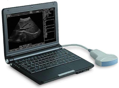 Портативный УЗИ аппарат SW-1200A B Mode Ultrasound Scanner (laptop/notebook)