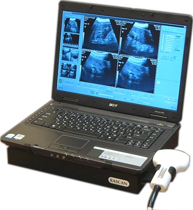 Переносной ультразвуковой сканер РACKAH ЭТС-Д-05ВП ветеринарный