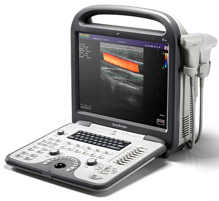 Ультразвуковой сканер SONOSCAPE S6Pro
