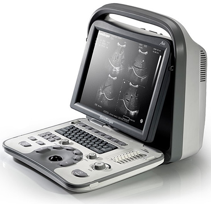 Ультразвуковой сканер SONOSCAPE A6 (черно-белый)