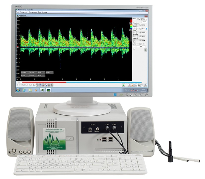 Допплеровский анализатор КОМПЛЕКСМЕД Исполнение 2.1