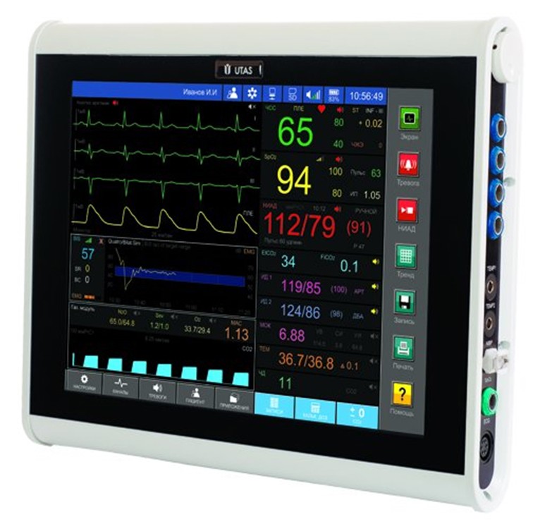 Монитор пациента ЮМ 300 - 15