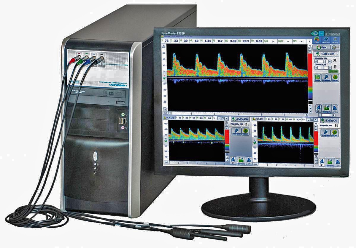 Допплеровский анализатор АНГИОДИН-К