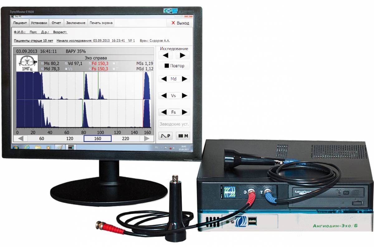 Эхоэнцефалограф АНГИОДИН-ЭХО/Б
