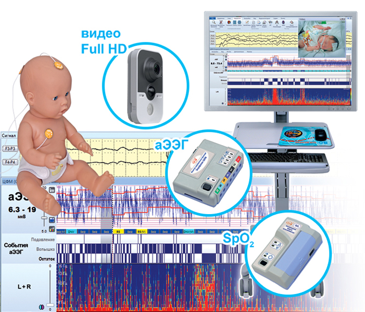 Монитор церебральных функций ЭНЦЕФАЛАН-ЦФМ